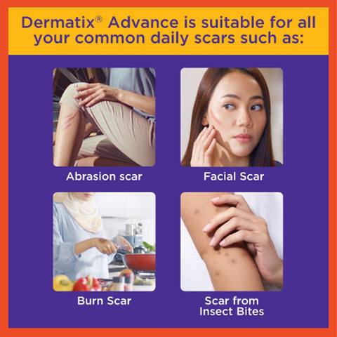 Dermatix Advanced Scar Formula Gel 9g