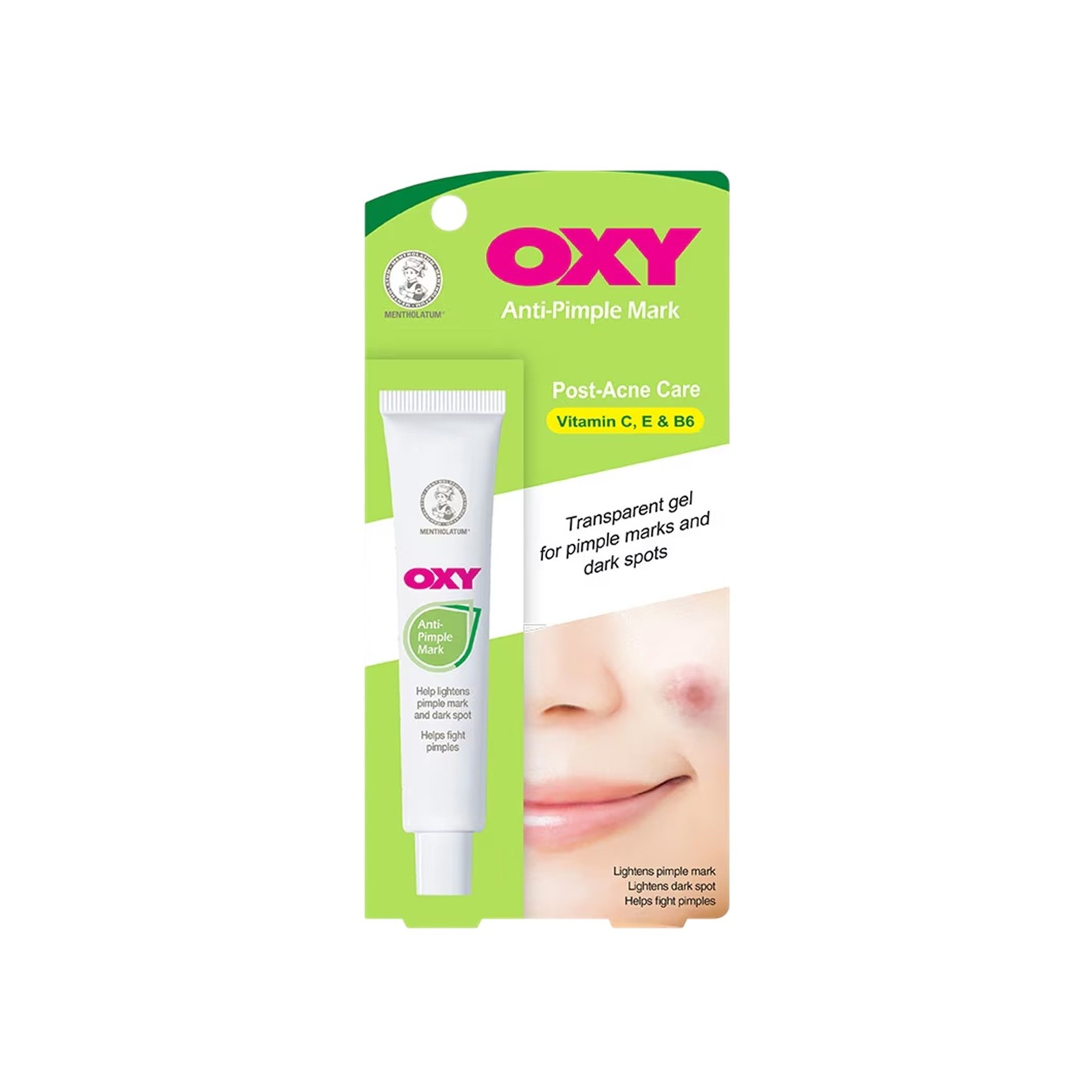 Oxy Anti-Pimple Mark Gel 18g (Post-Acne Care)