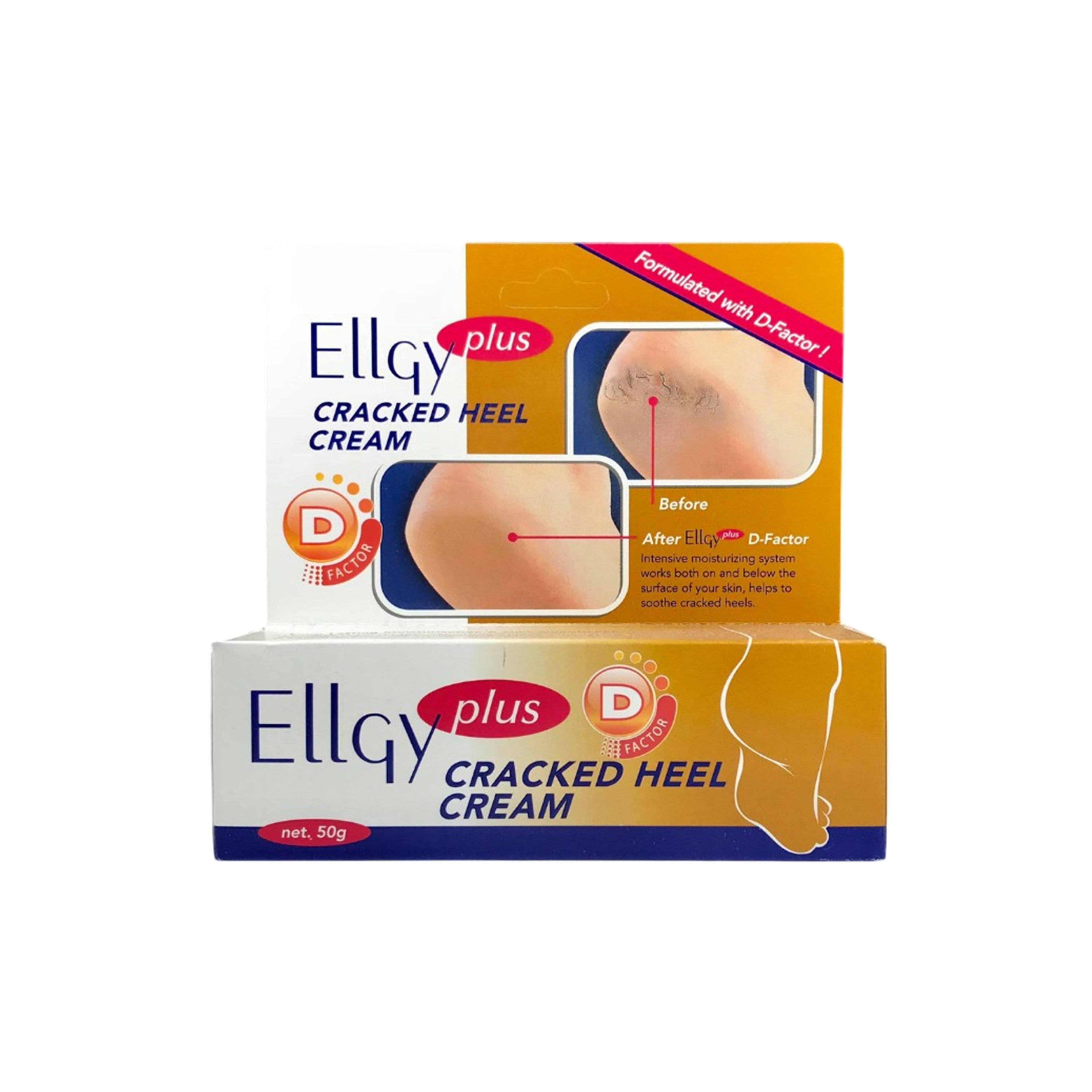 EllGy Plus D-Factor Cracked Heel Cream 50g