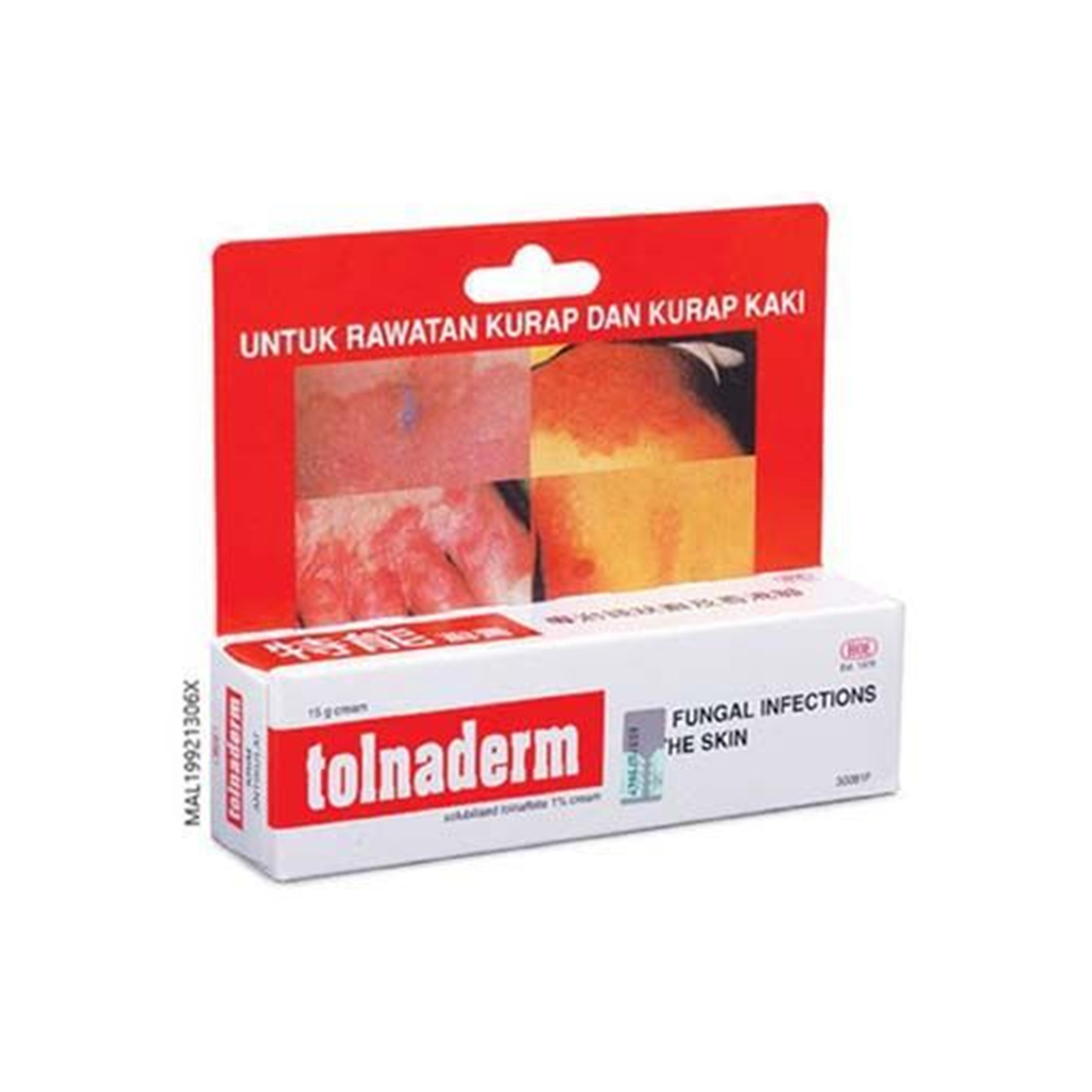 Tolnaderm (Solubilised Tolnaftate 1% ) Cream 15g - For Fungal Infections of the Skin