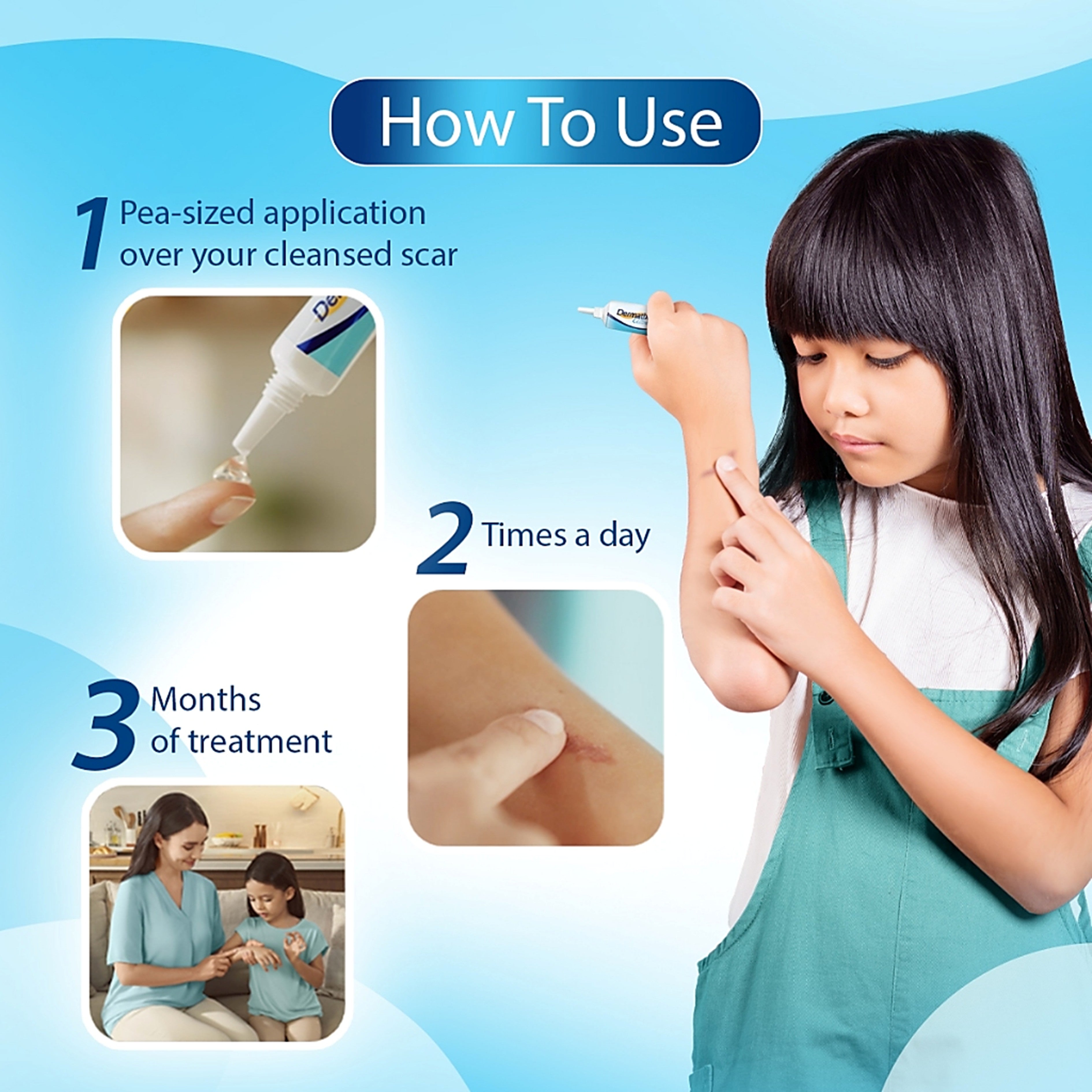Dermatix Ultra Kids Gel - Advanced Scar Formula, Scar Care for Kids (9g)