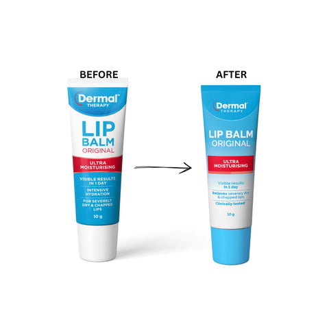 Dermal Therapy Lip Balm Original (Ultra Moisturising) 10g