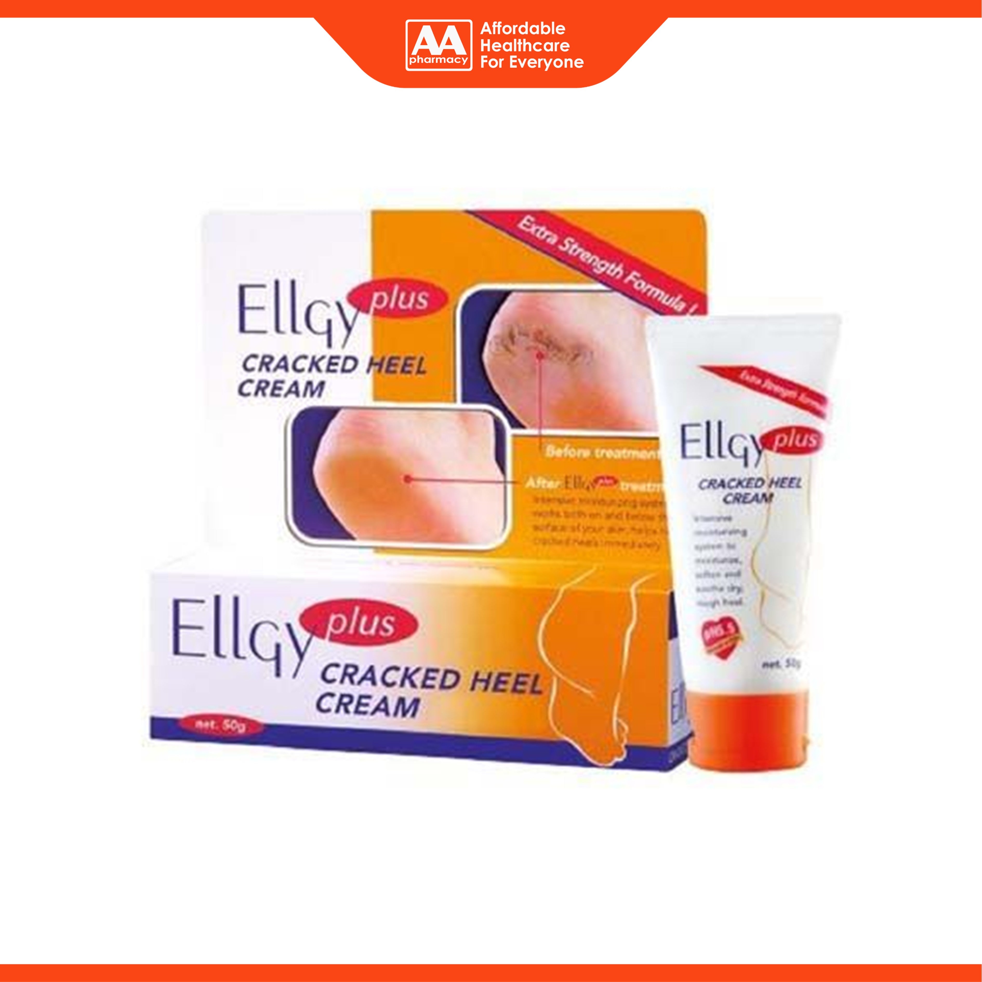 EllGy Plus Cracked Heel Cream (50g) - Extra Strength Formula