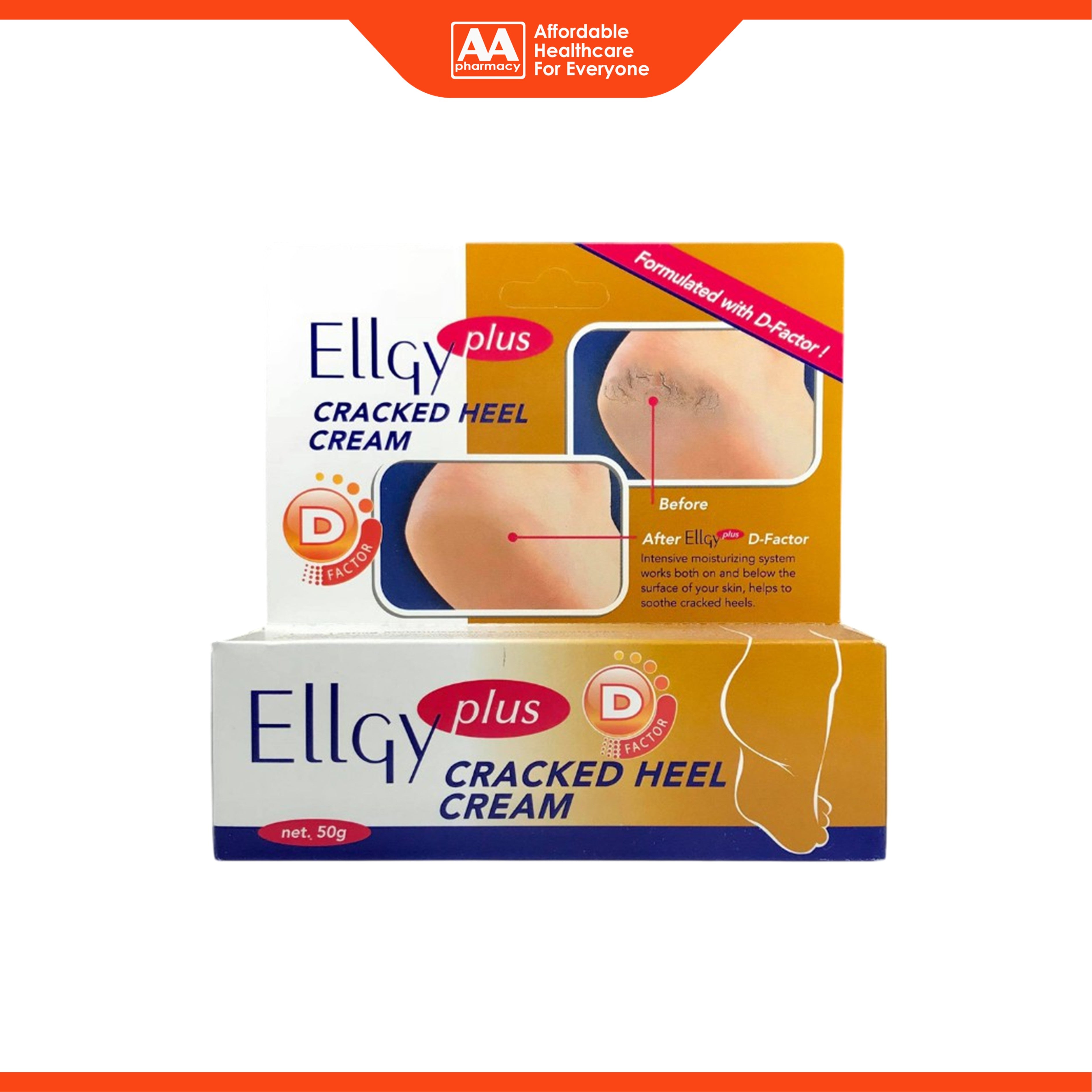 EllGy Plus D-Factor Cracked Heel Cream (50g)