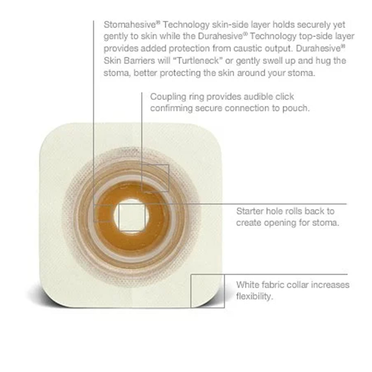ConvaTec Natura SUR-FIT Durahesive Moldable Convex Skin Barrier with Flange - 45mm, REF 404593 (10's)