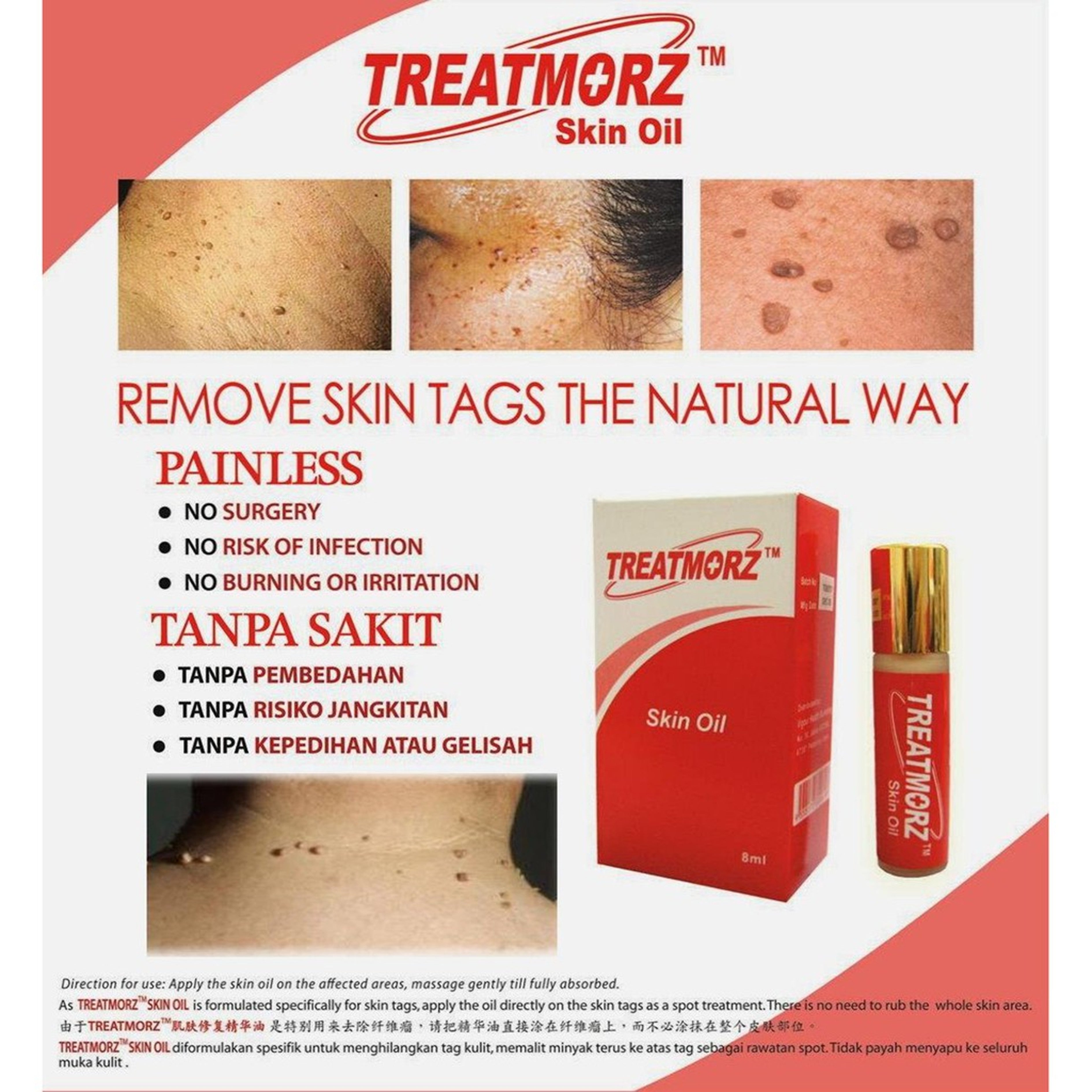 Treatmorz Skin Oil 8mL