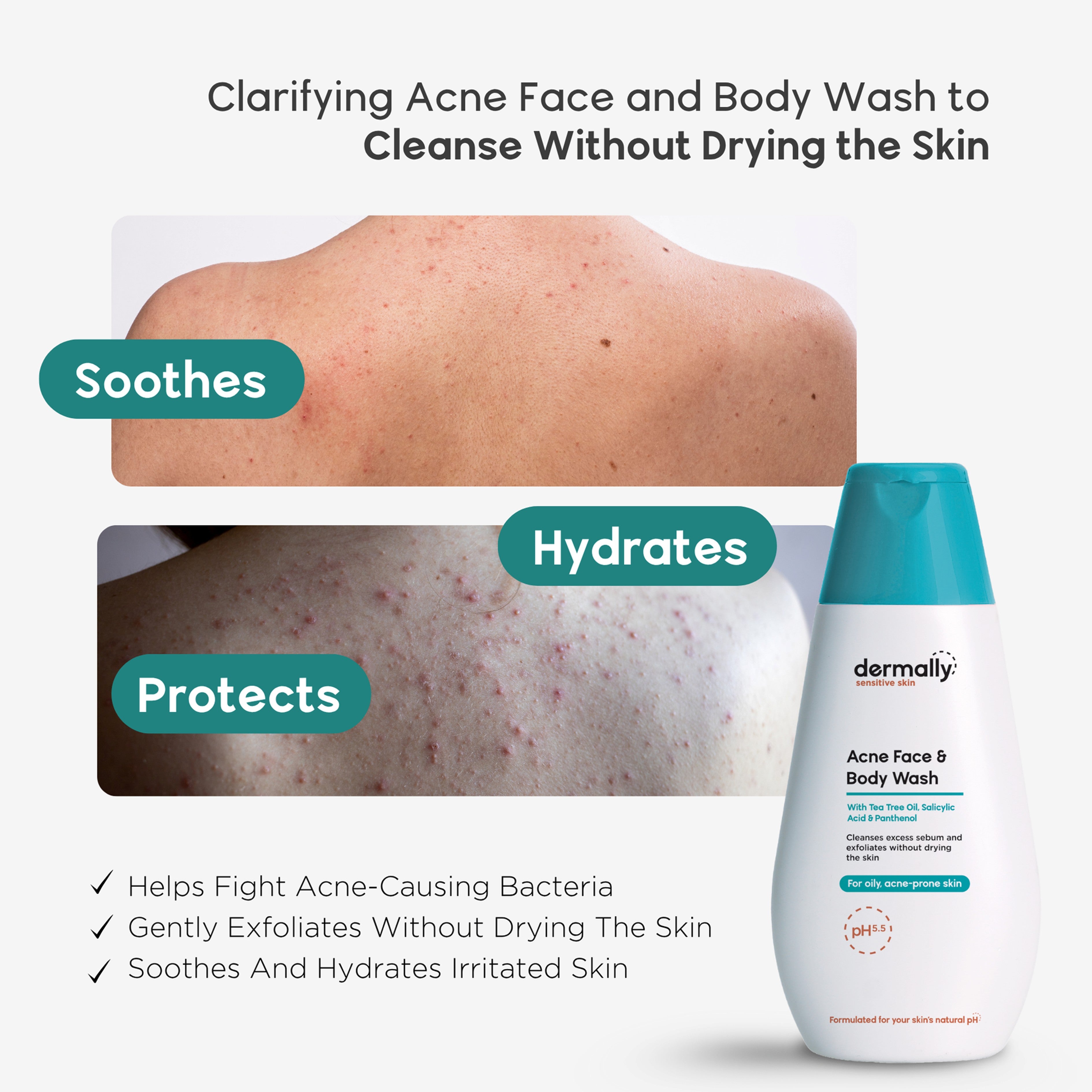 Dermally Sensitive Skin Acne Face and Body Wash 200mL