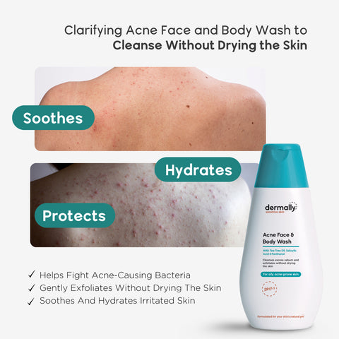 Dermally Sensitive Skin Acne Face and Body Wash 200mL
